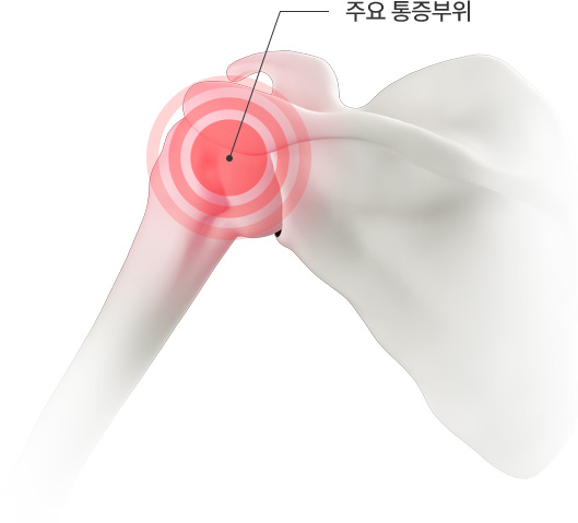 주요 통증부위