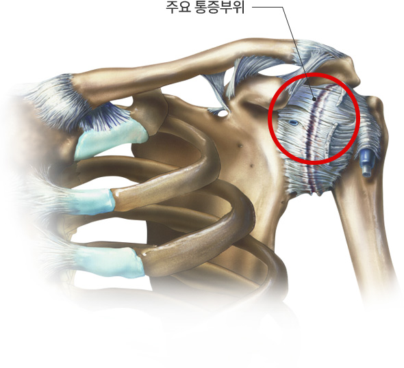 주요 통증부위