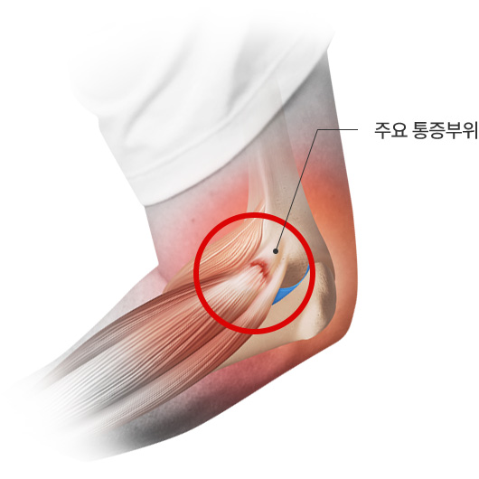 주요 통증부위